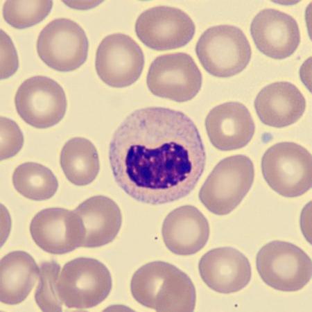 Hyposeg4