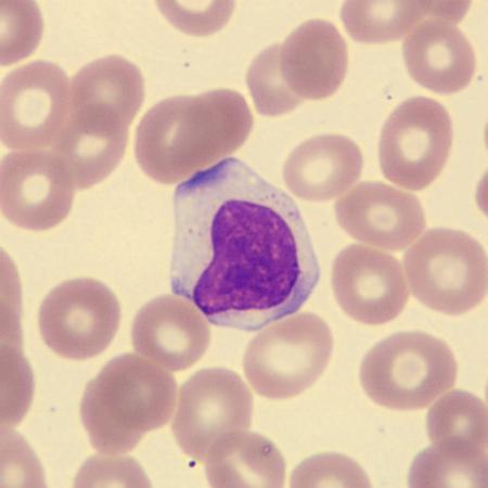 Largelymph2
