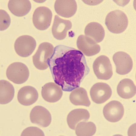 Largelymph4