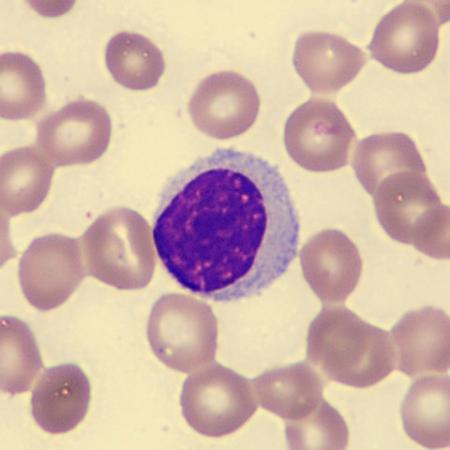Largelymph5