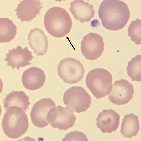 Macro1