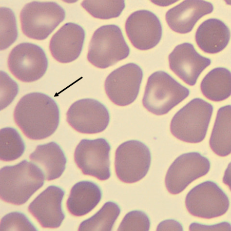 Macro2
