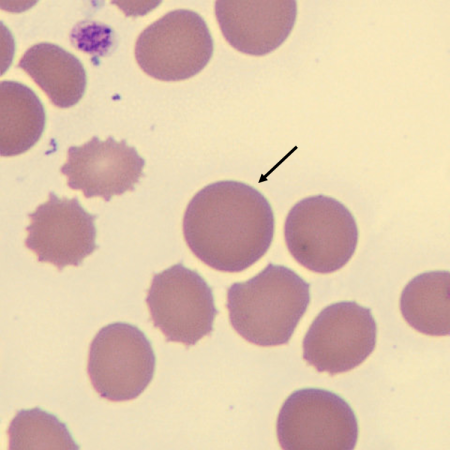 Macro4