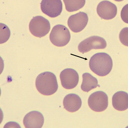 Macro5