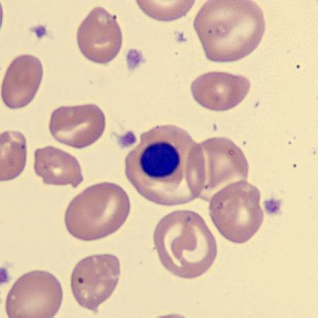 NRBC1