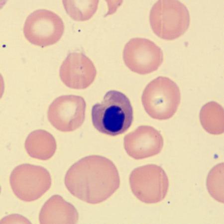 NRBC2