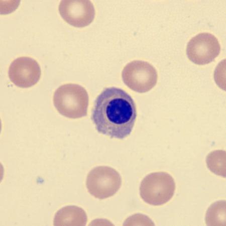 NRBC6