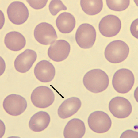 Ovalo1
