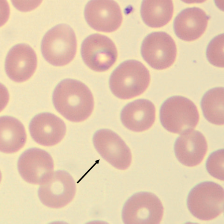 Ovalo2
