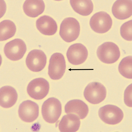 Ovalo3