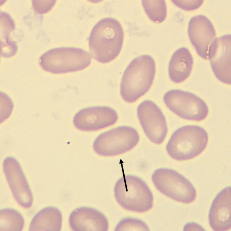 Ovalo5