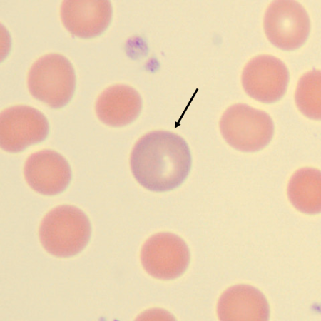 Poly2