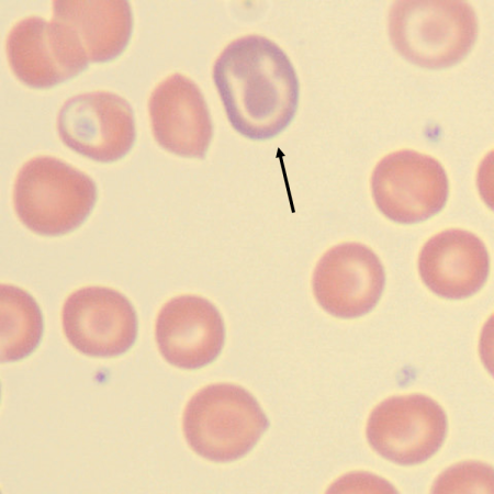 Poly3