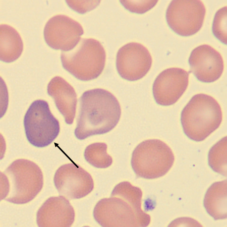Poly5