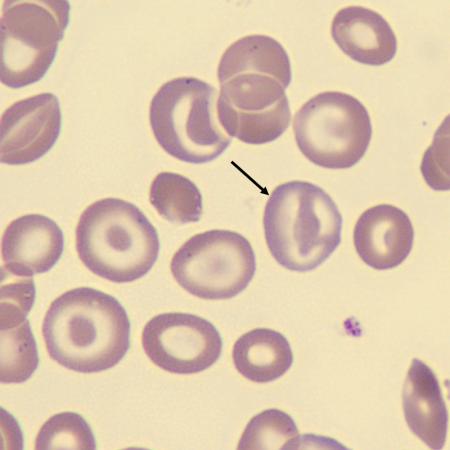 Poly6