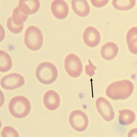 Schisto3