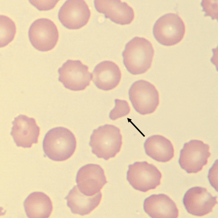 Schisto6