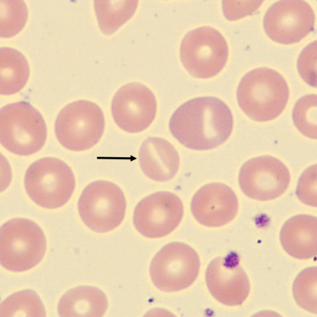Stoma2