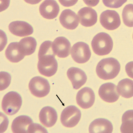 Stoma3
