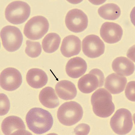 Stoma4