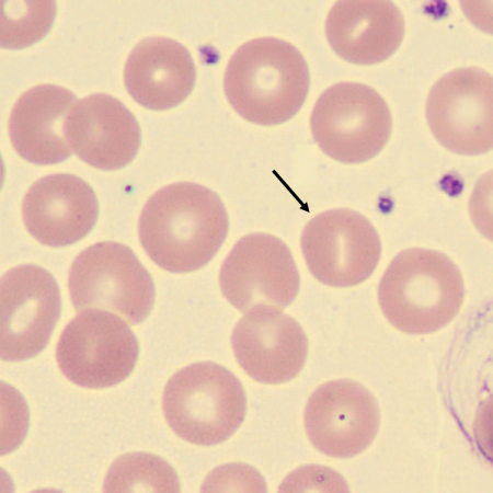 Stoma6