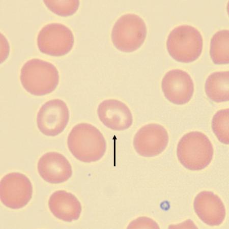 TC4