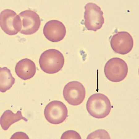 TC5