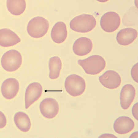 TD6