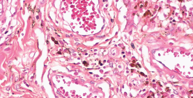 Staining bichromic variations