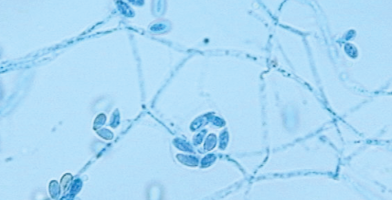 Staining lactophenol