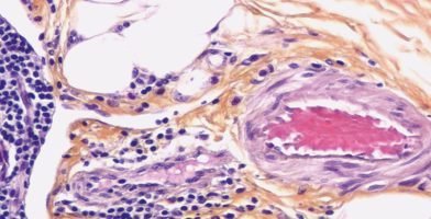 Trichromic staining by Addition of Saffron: Haematoxylin-Eosin-Saffron and Variations