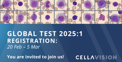 Global test 