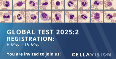 Global test 2025:2