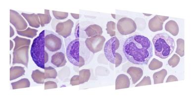blood cells