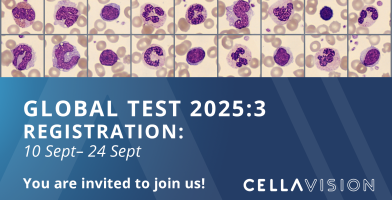 Global test 2025:3
