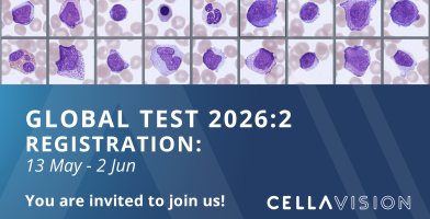 Global test 2026:2 banner
