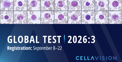 Global test 2026:3 banner