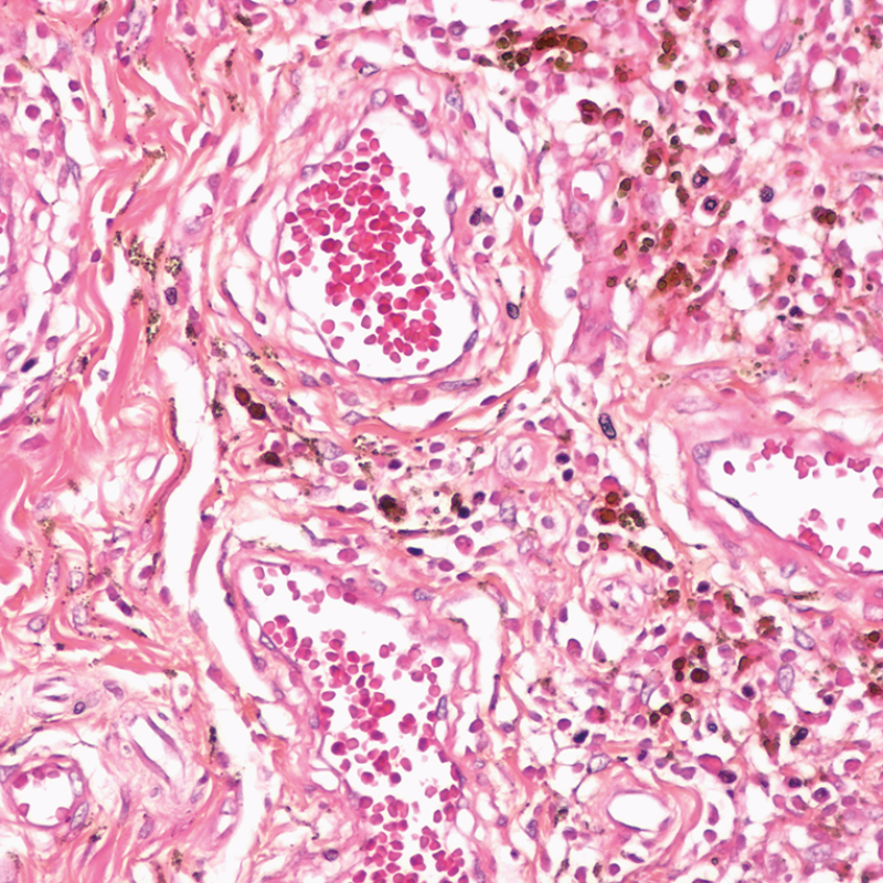 Staining bichromic variations