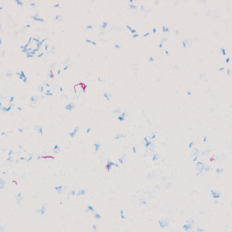 Staining cryptosporidium