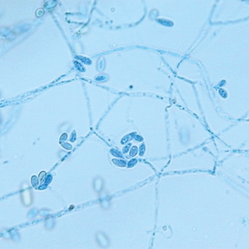 Staining lactophenol