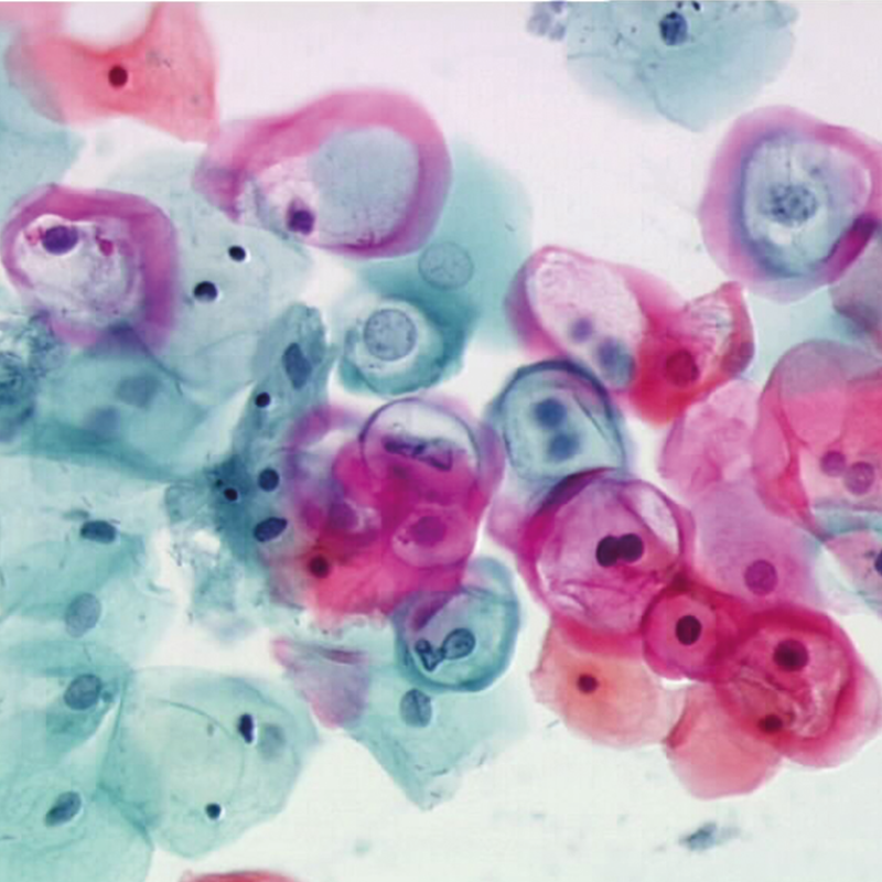Papanicolaou Staining CellaVision