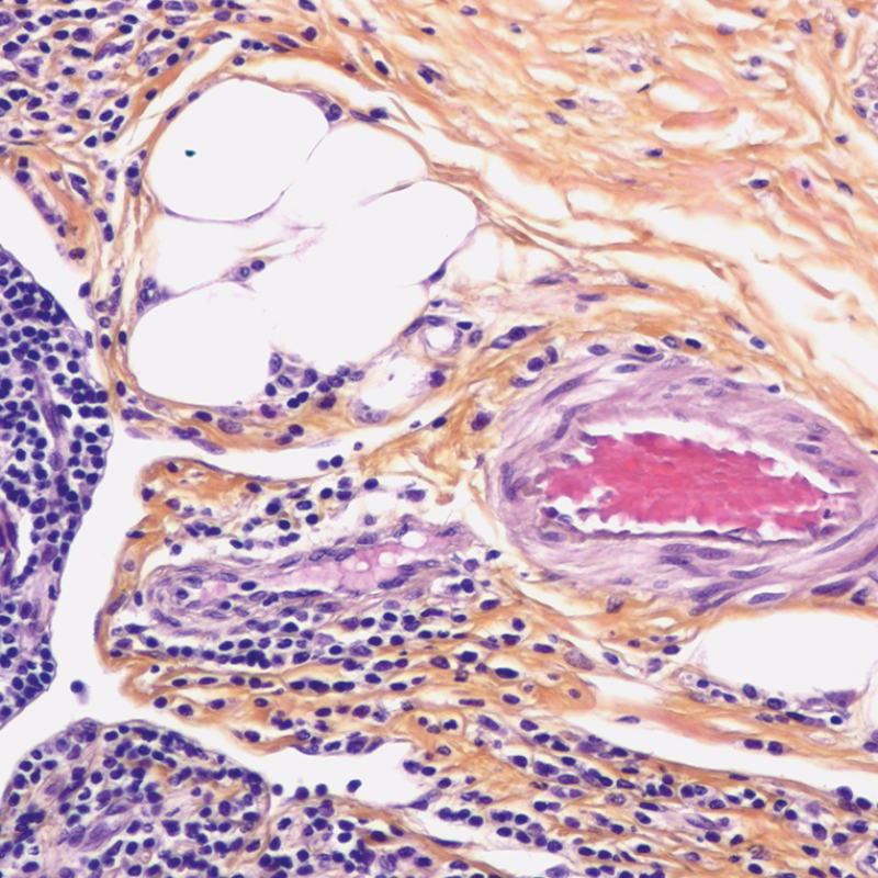 Trichromic staining by Addition of Saffron: Haematoxylin-Eosin-Saffron and Variations