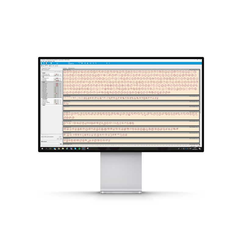 CellaVision Advanced RBC Application Software