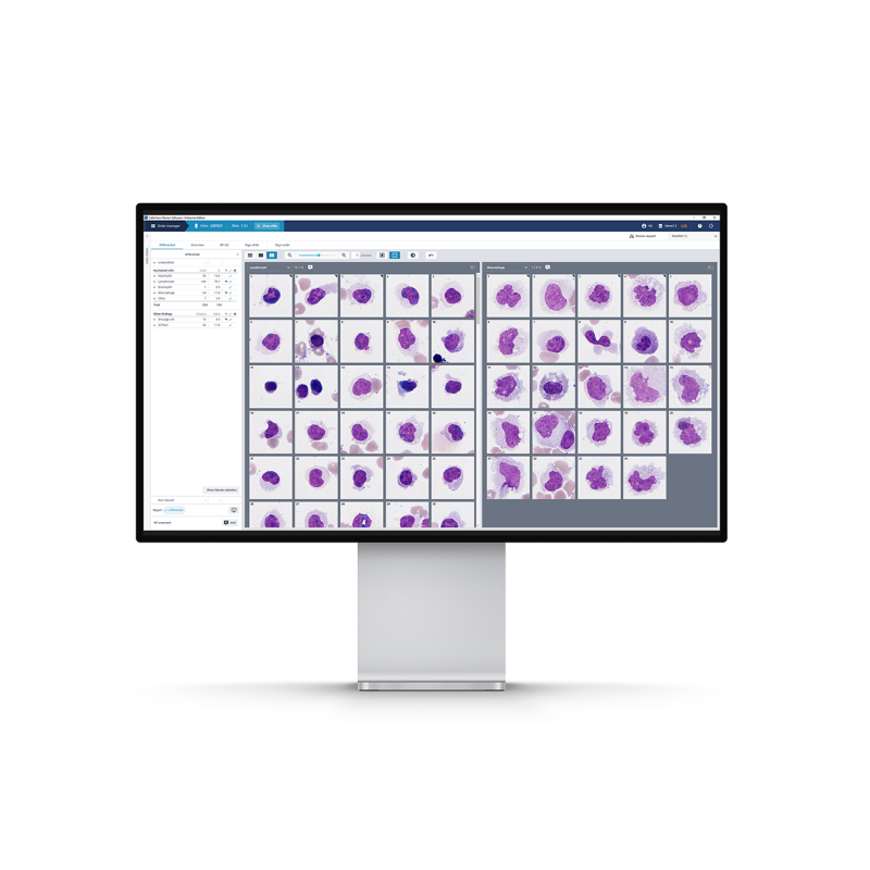 Body fluid product image