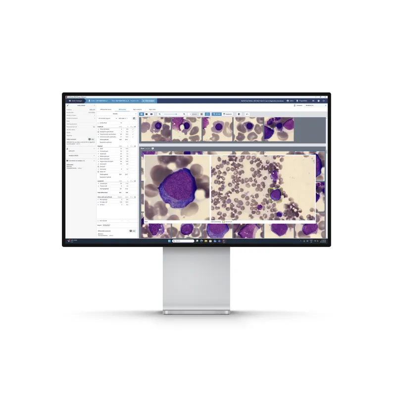 Bone marrow application software