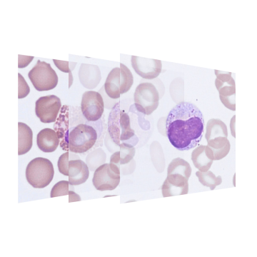 Blood cell basics
